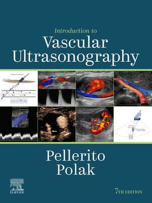 cover image of Introduction to Vascular Ultrasonography E-Book